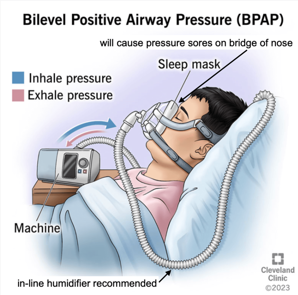 Breathing Equipment - image11