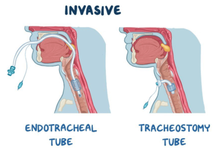 Breathing Equipment - image12