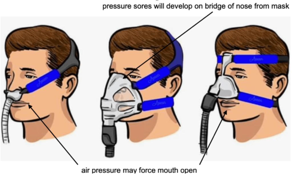 Breathing Equipment - image9