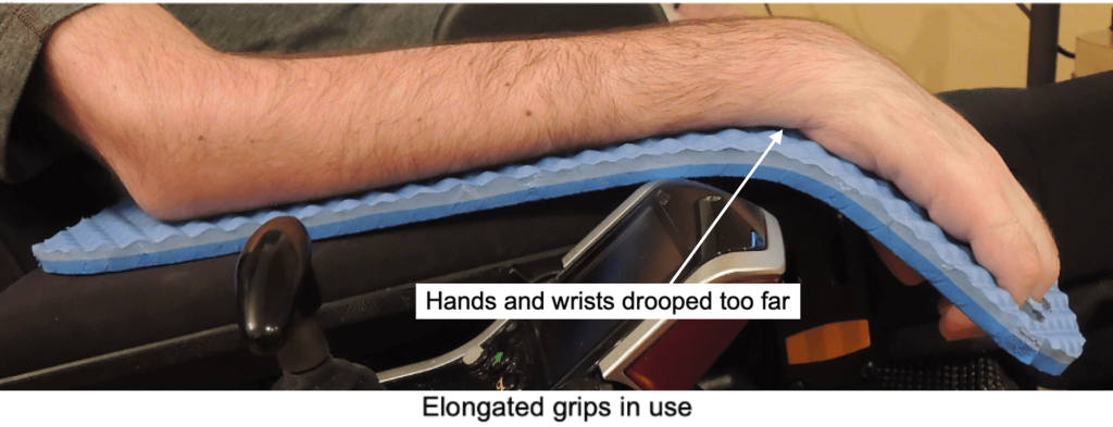 Devices for the Hands, Wrists and Arms - image10