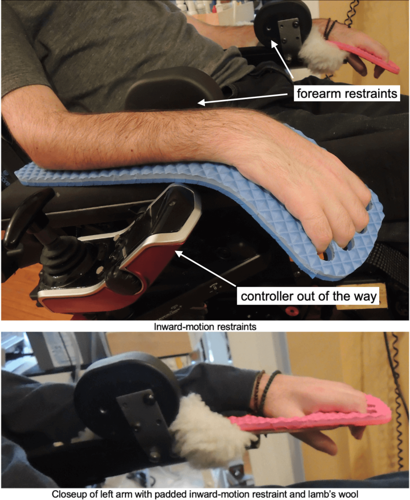 Devices for the Hands, Wrists and Arms - image15