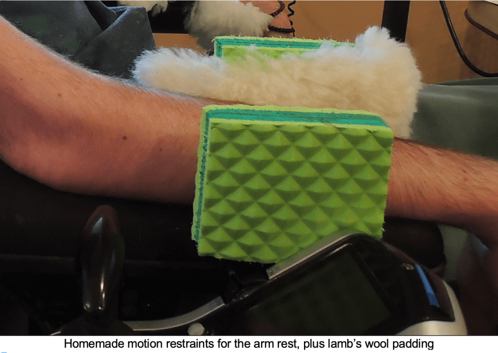 Devices for the Hands, Wrists and Arms - image16